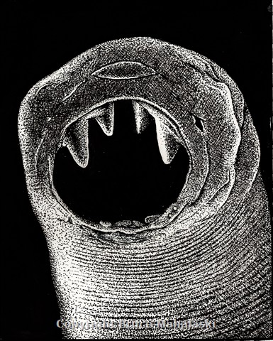 Hookworm-  picture